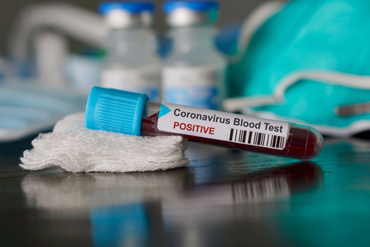 Covid-19: US tourist is Costa Rica’s first coronavirus case and first in Central America