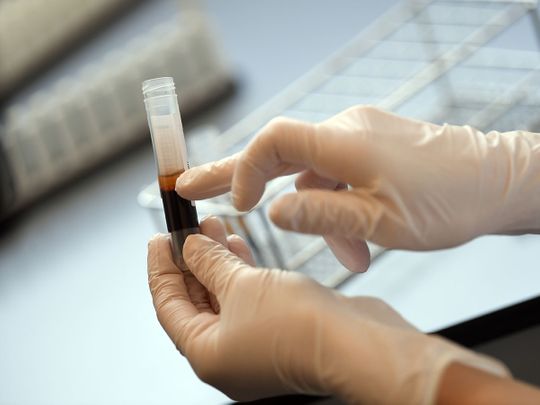 Dubai Health To Start Treating COVID-19 Patients With Blood Plasma