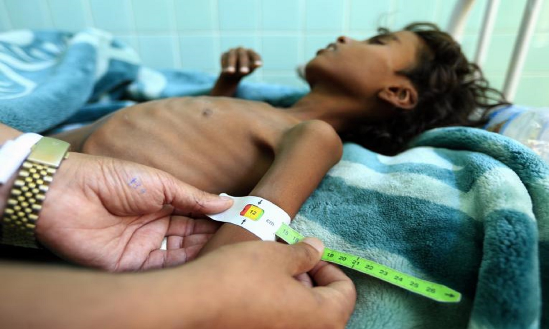 21 Million Yemenis Need Life-Saving Aid, Half Are Children: UNICEF
