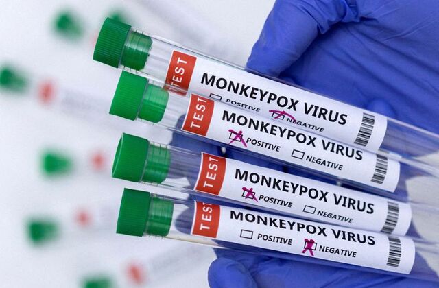 US expanding monkeypox testing capacity as cases rise