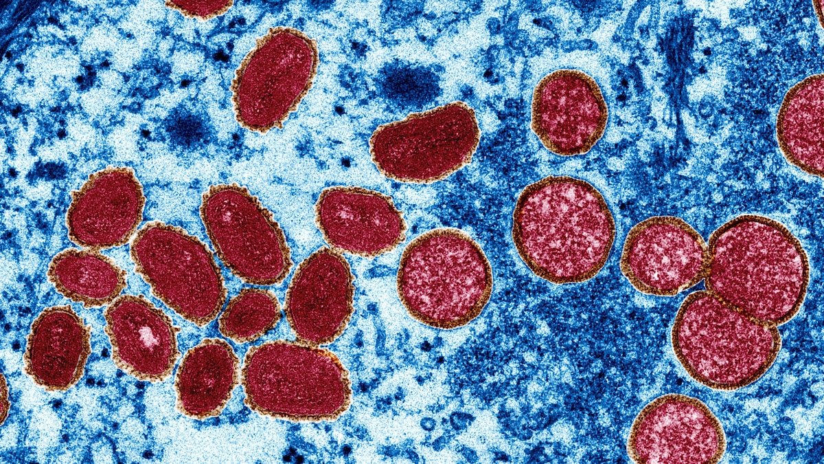 WHO: 780 monkeypox outbreak cases