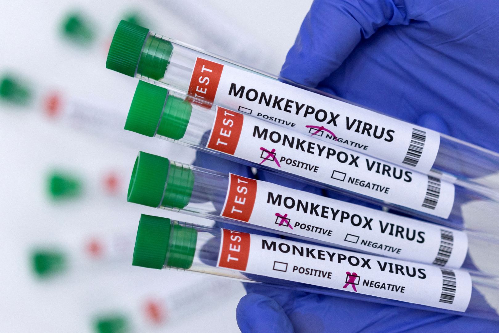 Thailand confirms first case of monkeypox infection