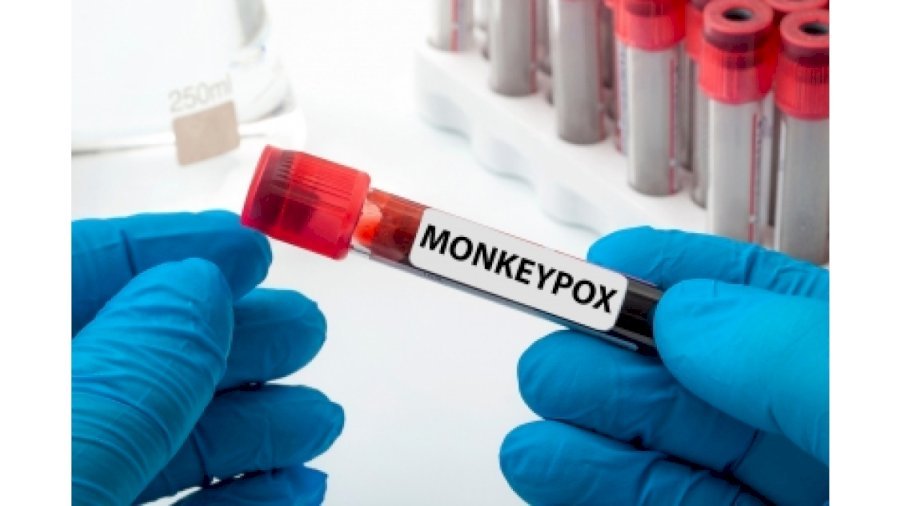 WHO donates to Uganda 2,400 monkeypox test kits