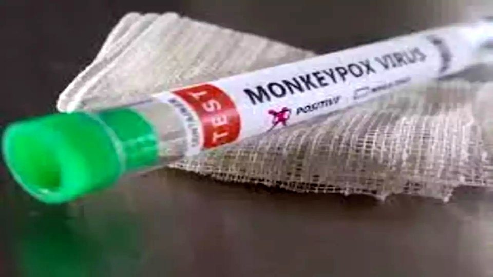 Peru registers first death in monkeypox patient: hospital