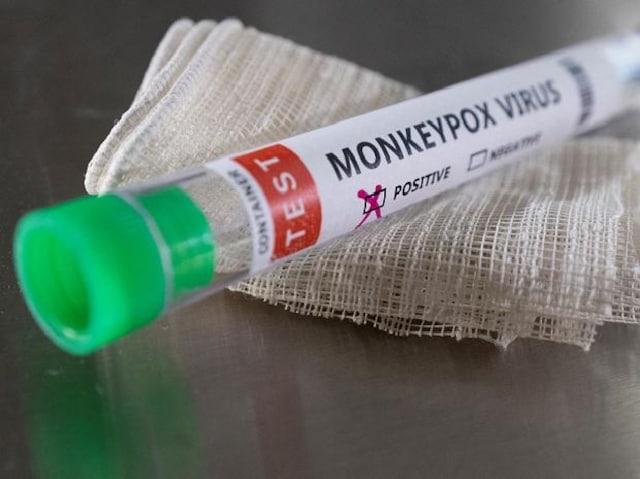 Monkeypox cases rise to 93 in Ecuador