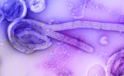 Equatorial Guinea confirms first-ever Marburg virus outbreak