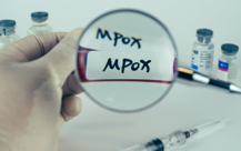 South Africa: Mpox cases rise to 20 with infections expected to increase