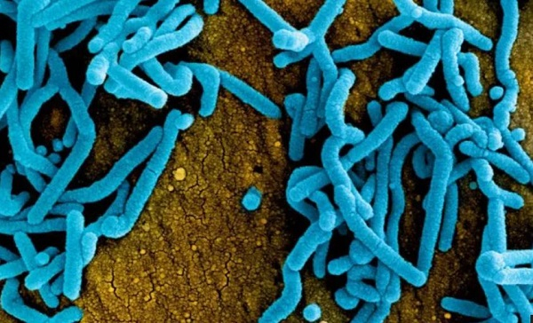 New Ebola cluster detected in Uganda, Africa CDC says