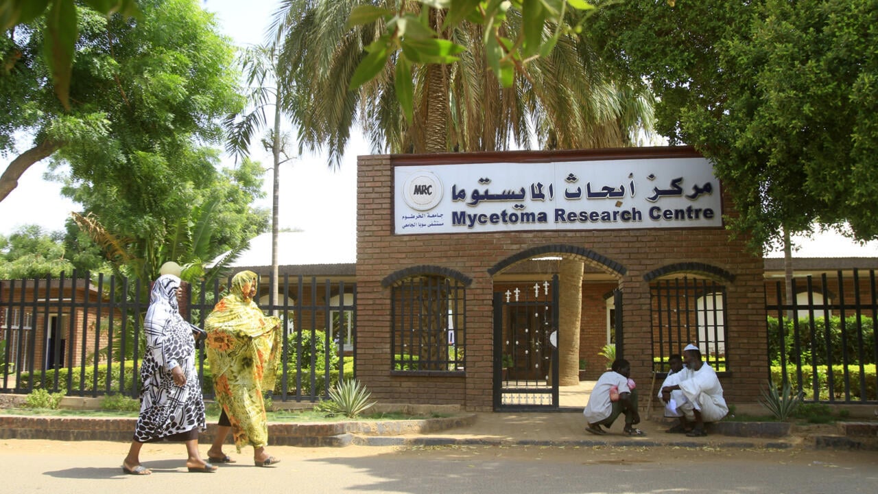 Sudan war destroys world’s only research centre on skin disease mycetoma: director
