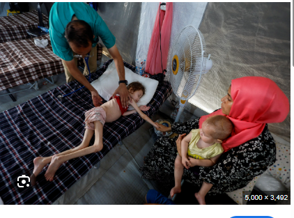 Number Of Malnutrition-Related Deaths In Gaza Rises To 227: UN