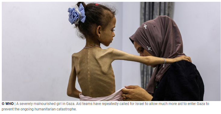 Gaza Starvation Deaths Continue To Rise: UN