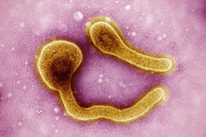 Ethiopia: Death toll from Marburg outbreak rises to 5